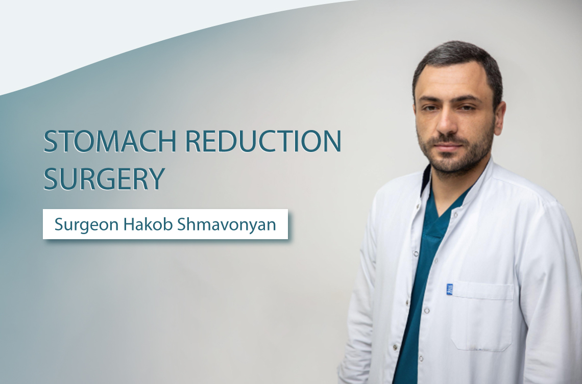 <p><strong>Stomach reduction surgery: What you need to know</strong></p>