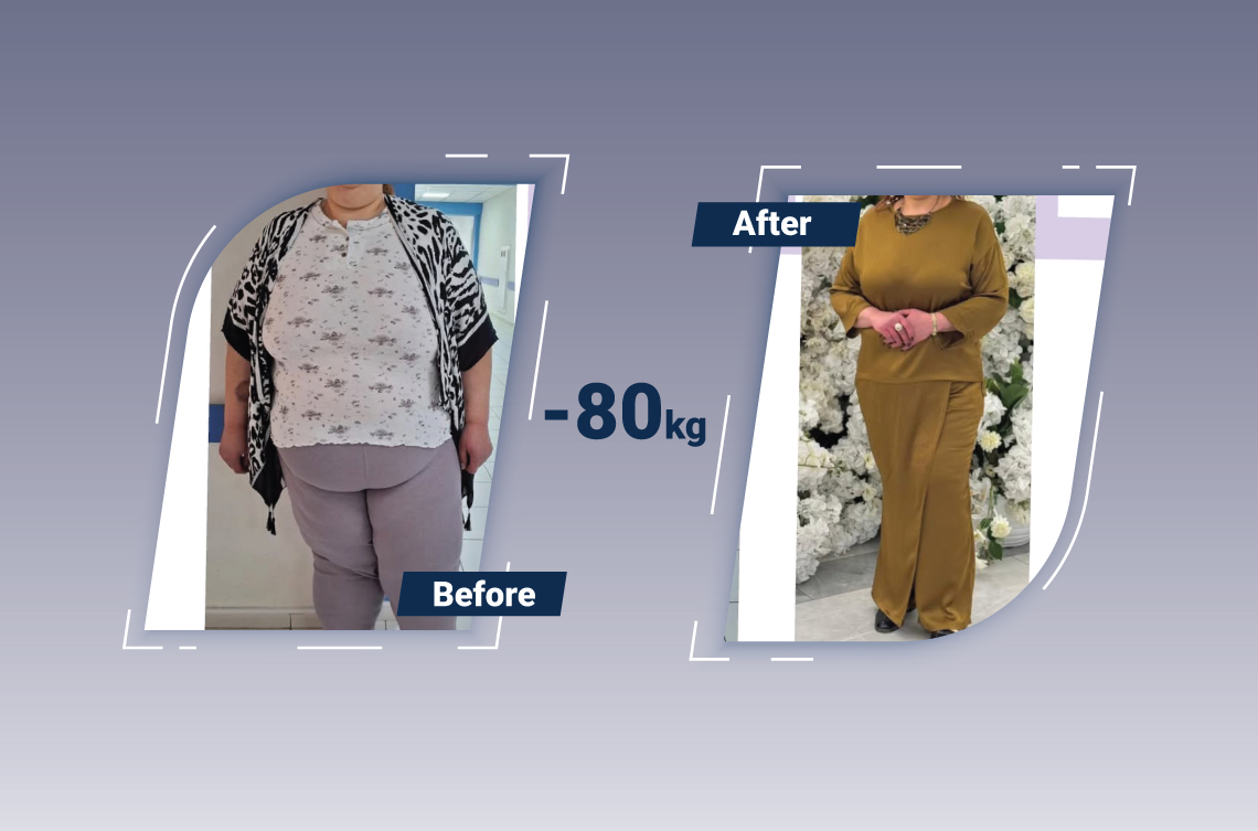 Bariatric Surgery — Measurable Results and Improved Quality of Life