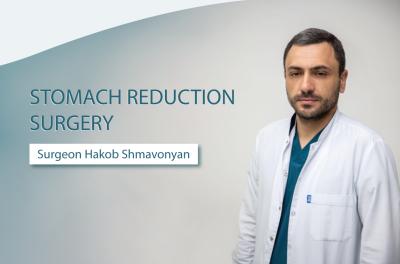 Stomach reduction surgery: What you need to know