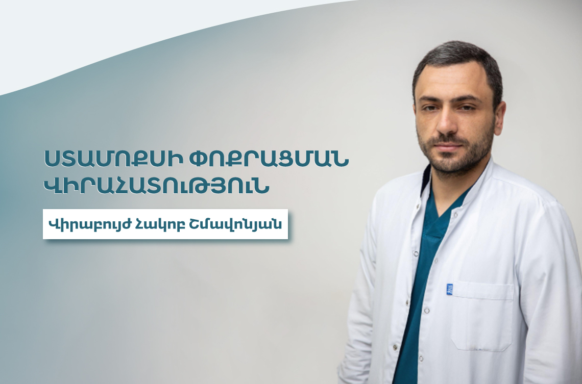 <p><strong>Ստամոքսի փոքրացման վիրահատություն. ի՞նչ պետք է իմանալ</strong></p>